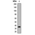 LifeSab™ ELMOD2 Rabbit pAb (50 µl)