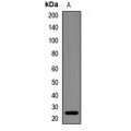 LifeSab™ NDUFS7 Rabbit pAb (50 µl)