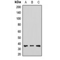 LifeSab™ RDH5 Rabbit pAb (50 µl)