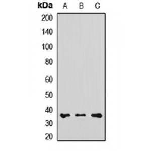LifeSab™ RDH5 Rabbit pAb (50 µl)