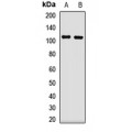 LifeSab™ TRPC6 Rabbit pAb (50 µl)
