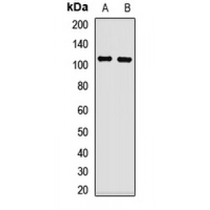 LifeSab™ TRPC6 Rabbit pAb (50 µl)