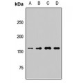 LifeSab™ KDM6A Rabbit pAb (50 µl)
