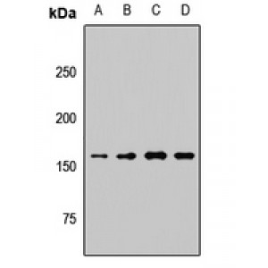 LifeSab™ KDM6A Rabbit pAb (50 µl)