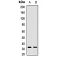 LifeSab™ Syntaxin 12 Rabbit pAb (50 µl)