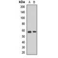 LifeSab™ ARFGAP3 Rabbit pAb (50 µl)