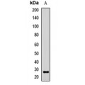 LifeSab™ Noggin Rabbit pAb (50 µl)