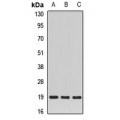 LifeSab™ SCAND1 Rabbit pAb (50 µl)