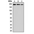 LifeSab™ PARP4 Rabbit pAb (50 µl)