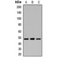LifeSab™ HLA-E Rabbit pAb (50 µl)
