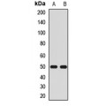 LifeSab™ Kir2.3 Rabbit pAb (50 µl)