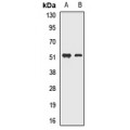 LifeSab™ MEIS2 Rabbit pAb (50 µl)