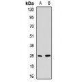 LifeSab™ PDC Rabbit pAb (50 µl)