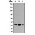 LifeSab™ ST13 Rabbit pAb (50 µl)
