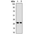 LifeSab™ RPP30 Rabbit pAb (50 µl)