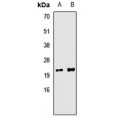 LifeSab™ Tim9B Rabbit pAb (50 µl)