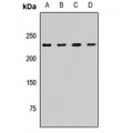 LifeSab™ CKAP5 Rabbit pAb (50 µl)