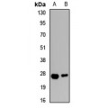 LifeSab™ Aquaporin 8 Rabbit pAb (50 µl)