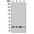 LifeSab™ Aquaporin 9 Rabbit pAb (50 µl)