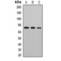 LifeSab™ CD125 Rabbit pAb (50 µl)