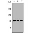 LifeSab™ UTY Rabbit pAb (50 µl)