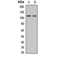 LifeSab™ Herc3 Rabbit pAb (50 µl)