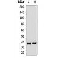 LifeSab™ FBXO2 Rabbit pAb (50 µl)