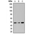 LifeSab™ TMPRSS11A Rabbit pAb (50 µl)