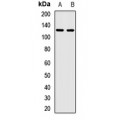LifeSab™ KIFC3 Rabbit pAb (50 µl)