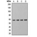 LifeSab™ ALDH7A1 Rabbit pAb (50 µl)