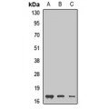 LifeSab™ GMF beta Rabbit pAb (50 µl)