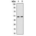 LifeSab™ TRIM44 Rabbit pAb (50 µl)