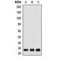 LifeSab™ CACYBP Rabbit pAb (50 µl)