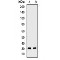 LifeSab™ SNRPB2 Rabbit pAb (50 µl)
