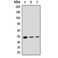 LifeSab™ GCDH Rabbit pAb (50 µl)