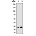 LifeSab™ CRALBP Rabbit pAb (50 µl)