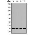 LifeSab™ CLPP Rabbit pAb (50 µl)