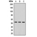 LifeSab™ MGAT2 Rabbit pAb (50 µl)