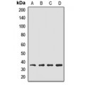 LifeSab™ EBP2 Rabbit pAb (50 µl)