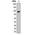 LifeSab™ PYGM Rabbit pAb (50 µl)