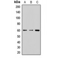 LifeSab™ FTCD Rabbit pAb (50 µl)