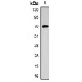 LifeSab™ NIS Rabbit pAb (50 µl)