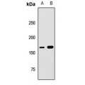 LifeSab™ UACA Rabbit pAb (50 µl)