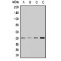 LifeSab™ BCKDHA Rabbit pAb (50 µl)