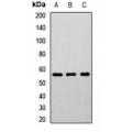 LifeSab™ CHRNB2 Rabbit pAb (50 µl)