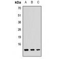 LifeSab™ GUCA2A Rabbit pAb (50 µl)