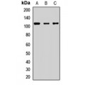 LifeSab™ RNase L Rabbit pAb (50 µl)