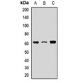 LifeSab™ RPE65 Rabbit pAb (50 µl)