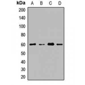 LifeSab™ CDY1 Rabbit pAb (50 µl)