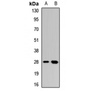 LifeSab™ Dectin 1 Rabbit pAb (50 µl)